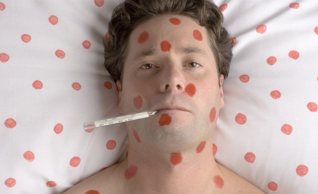 340 жителей Донецкой области заболели корью с начала года — МОЗ