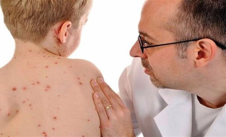 Про грип та кір у цифрах