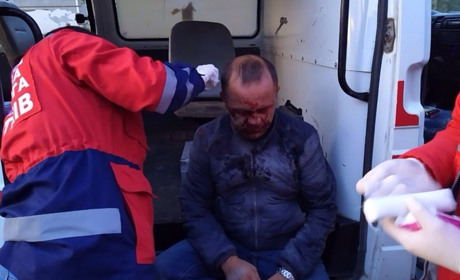 Через глибоку вибоїну на дорозі  у Білобожниці серйозно травмувався скутерист