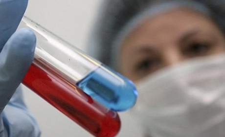 Є результати аналізів по менінгіту: патогенних бактерій не виявлено