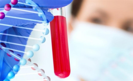 ВІЛ і СНІД: питання і відповіді. У чому їх відмінність і чому їх всі бояться