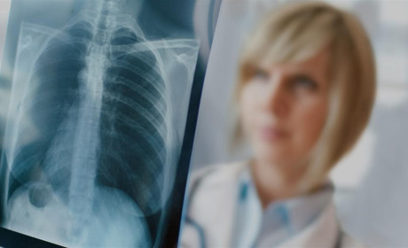 Для мешканців Добропільського району працюватиме пересувний рентген-кабінет