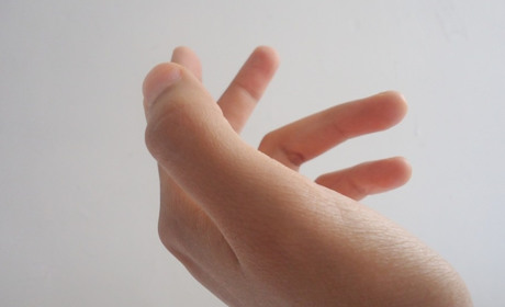 Жительку Старокостянтинова, яка має психічні розлади, визволяли з власної квартири