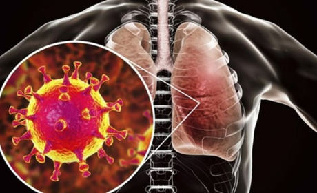  В Україні виявили перший випадок зараження Коронавірусом 