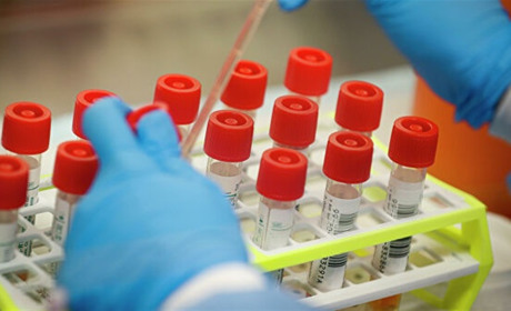 Із приємного: у першої інфікованої коронавірусом хмельничанки тест показав негативний результат