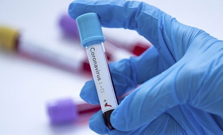 За минулу добу ще 13 хворих: ситуація COVID-19 на Житомирщині