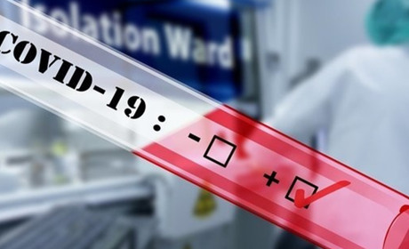 У Хмельницькій області зареєстровано 2 летальних випадки від COVID-19