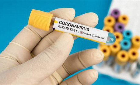 В  Троїцькому 12 пацієнтам зробили тест на коронавірус  