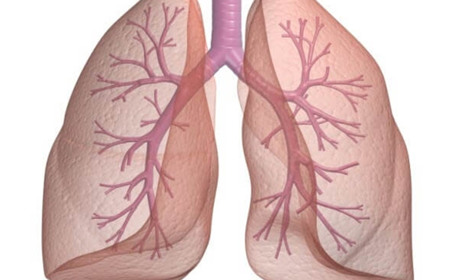 Що відбувається з легенями хворих на коронавірус