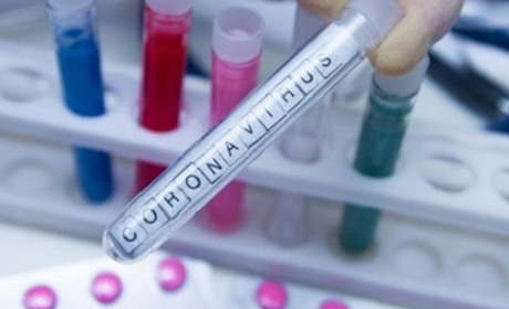 Плюс 415. В Україні підтвердили 6 125 випадків COVID-19
