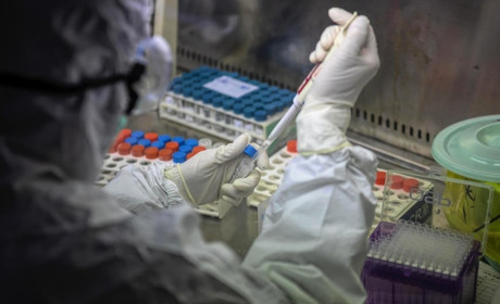 COVID-19 на Тернопільщині: уже 565