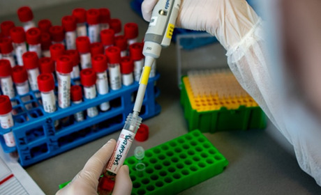 На Луганщині від коронавірусу одужало вже 4 людини