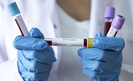 Станом на 30 квітня на Володимиреччині 6 хворих, 4 перевіряють, 123 на самоізоляції