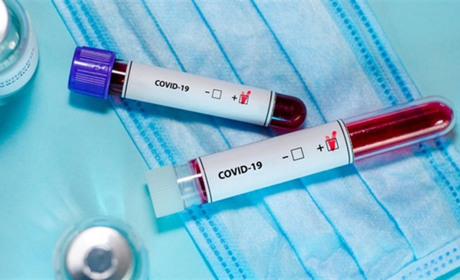10 інфікованих COVID-19 в Петропавлівці виздоровіли, у Миколаївській громаді 6 позитивних 
