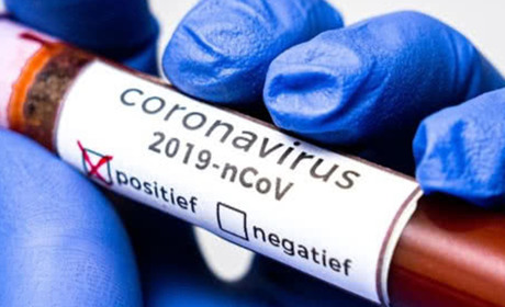 Епідситуація станом на 7 травня: на Володимиреччині 6 хворих і 2 підозри; у Вараші 3 хворих