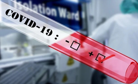 На Старокостянтинівщині виявлено хворих на COVID-19