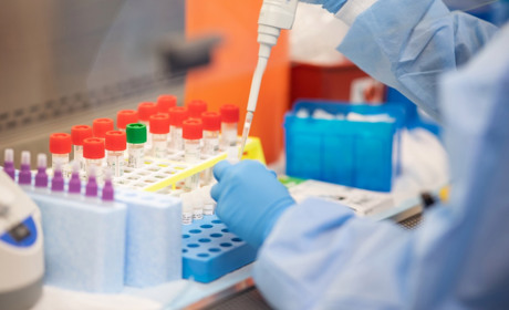 Маємо новини: про результати ПЛР-досліджень та стан хворих на COVID-19 старокостянтинівців