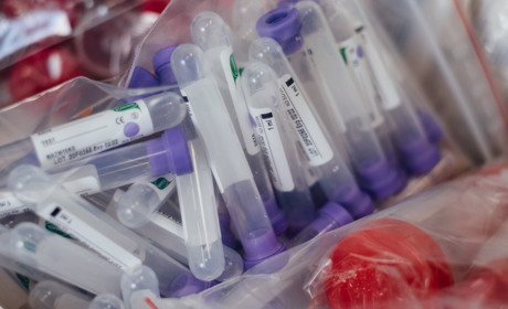 Коронавірус на Кагарличчині: за тиждень додалося одужавших від COVID-19