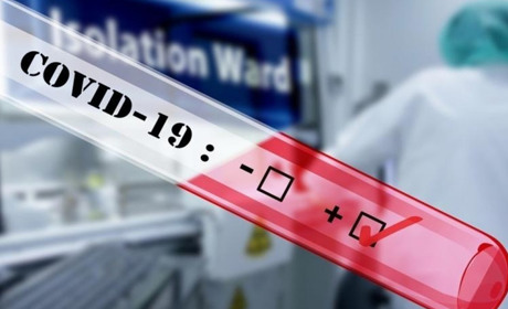 Позитивний результат експрес-тесту на коронавірус троїчанки не підтвердився лабораторно 