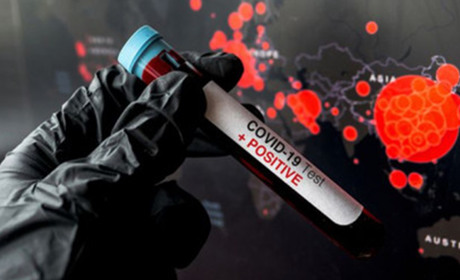 Коронавірусна статистика: на 1 червня у Вараші 25 хворих; у районі – 13 випадків 