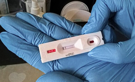 У 3 містах Хмельниччини розпочали ІФА-тестування