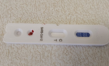 За минулу добу нових захворювань на COVID-19 на Луганщині немає
