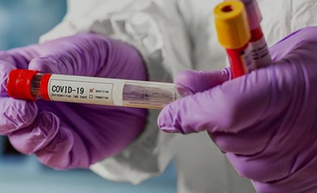 Оперативна ситуація на 11 червня: у Вараші 57 хворих на коронавірус, на Володимиреччині – 32 