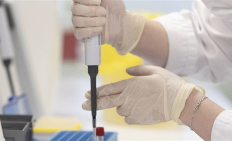 Плюс 683: в Україні більше  29 тисяч випадків COVID-19. У Калуші — 7 підозр за добу