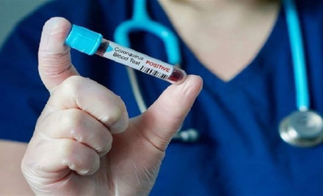 В Україні за добу через COVID-19 захворіла і померла рекордна кількість людей за весь час пандемії