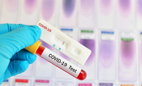 На Хмельниччині маємо 10 нових випадків COVID-19: додалося і в Старокостянтинові 