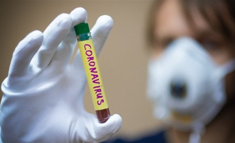 COVID-19: за минулу добу четверо хворих, але мешканців району лише троє, один у Чорткові