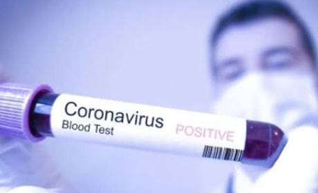 Короновірусний антирекорд в Україні: до мешканців Сумщини звернувся голова ОДА Роман Грищенко