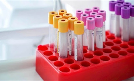 У одному з районів Хмельницької області за добу підтвердили 74 випадки COVID-19