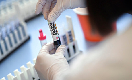 Ситуація з коронавірусом на 26 червня: у Вараші 116 випадків захворювань, на Володимиреччині – 80