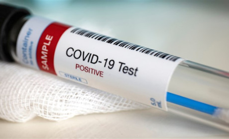 Від коронавірусу у Старокостянтинівському районі помер чоловік 