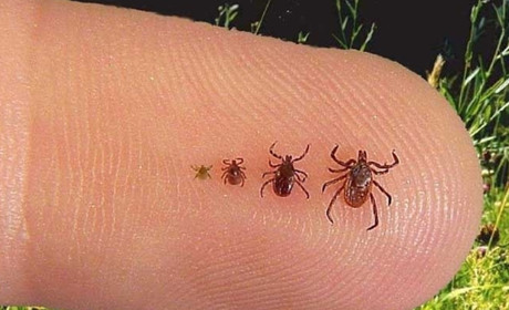 Що робити, якщо присмоктався кліщ: як витягнути в домашніх умовах і коли варто звертатися до лікаря