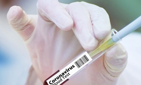 В Україні за добу COVID-19 підтвердили у 807 людей: як змінилася ситуація у Луганській області