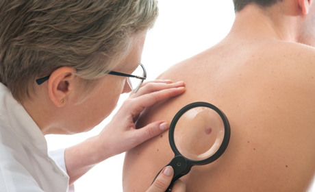 Онкологія: чи завжди діагноз - вирок? 