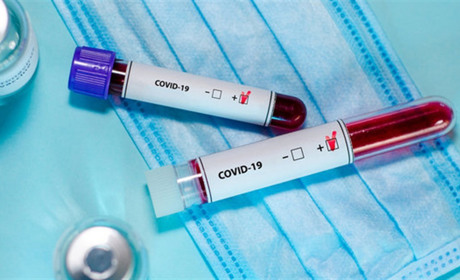 28 одужалих та нові випадки: офіційна статистика COVID-19 на Житомирщині