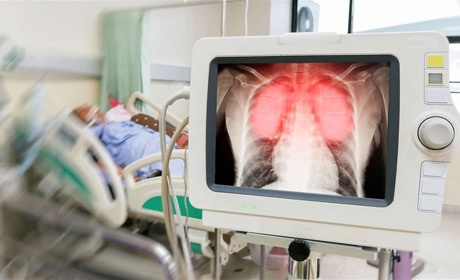 Три людини з COVID-19 померли за добу в Одеській області 