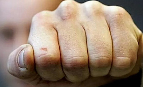 В Измаиле трое парней избили полицейского до потери сознания