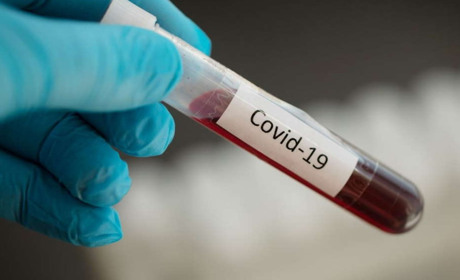 COVID-19: Тільки спільними зусиллями зупинимо його