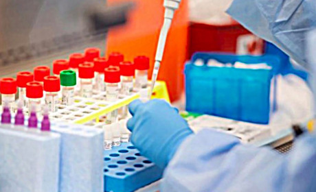 У Старокостянтинові розпочали проводити ІФА-тестування 