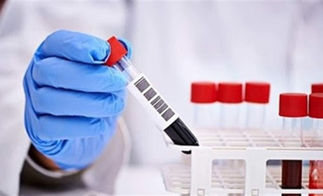 У яких населених пунктах Кіцманщини зафіксовано нові випадки COVID-19 наприкінці липня