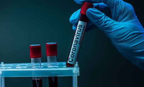 Плюс два у Старокостянтинові та два в районі: хворих на COVID-19 знову додалося