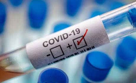Де зафіксовано нові випадки COVID-19 у Кіцманському районі станом на 11 серпня