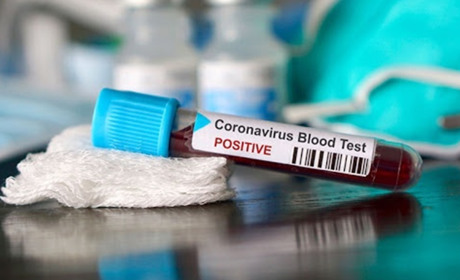 У місті рекордна кількість хворих: негативна динаміка COVID-19 на Новоград-Волинщині