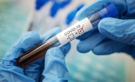 У Шостці за добу COVID-19 підтвердили у чотирьох осіб. Що про них відомо?