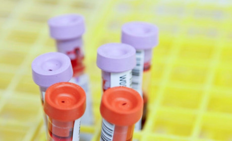 У Пологах спалах COVID-19, третина хворих – парафіяни однієї церкви