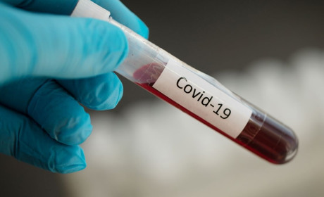 За пів дня на Хмельниччині додалося 111 хворих на COVID-19